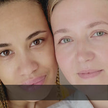 Load and play video in Gallery viewer, Advanced Scar Treatment For Deep Scars & Dark Spots | Pits & Scars Combo