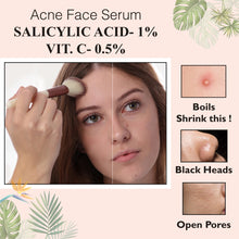 Load image into Gallery viewer, acne face serum , acne serum, acne control cream, remove scars, pits removal cream, serum for acne, anti wrinkles, wrinkles free face serum , anti aging, fine lines control, skin, skincare, luxuri products, skin lightening, pores tightening, clear blemishes, dark spots removal cream