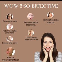 Load image into Gallery viewer, Cream For Reducing Dark Spots, Age spots , Wrinkles Removal Cream, Blemish Cream, Black Heads, Sun Damage Skin