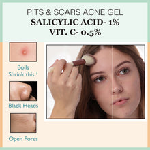 Load image into Gallery viewer, pits & scar gel, skin peeling serum, rejuvenates skin, acne serum, acne control cream,  remove scars, pits removal cream, serum for acne,  anti wrinkles, anti aging, fine lines control, skin, skincare, zenvista, organics products, skin lightening, pores tightening, clear blemishes, dark spots removal cream