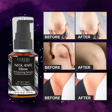 Load image into Gallery viewer, luxuri skin science Neck knee elbow whitening serum and cream for all neck knee elbow whitening and lightening serum and cream skin blemish remover skin firming serum knee whitening cream