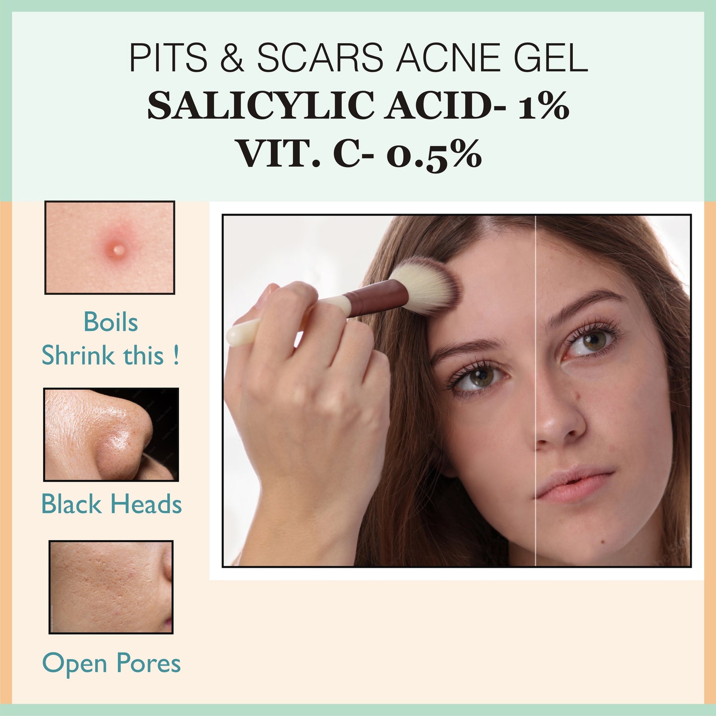 pits & scar gel, skin peeling serum, rejuvenates skin, acne serum, acne control cream,  remove scars, pits removal cream, serum for acne,  anti wrinkles, anti aging, fine lines control, skin, skincare, zenvista, organics products, skin lightening, pores tightening, clear blemishes, dark spots removal cream