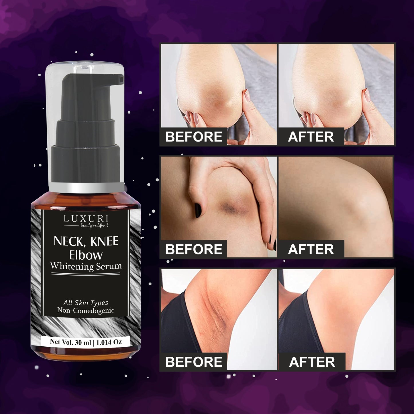 luxuri skin science Neck knee elbow whitening serum and cream for all neck knee elbow whitening and lightening serum and cream skin blemish remover skin firming serum knee whitening cream